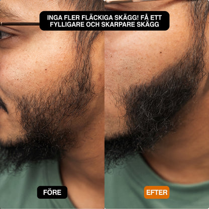 Hår Densitet Fyllning